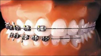 ortodonti2